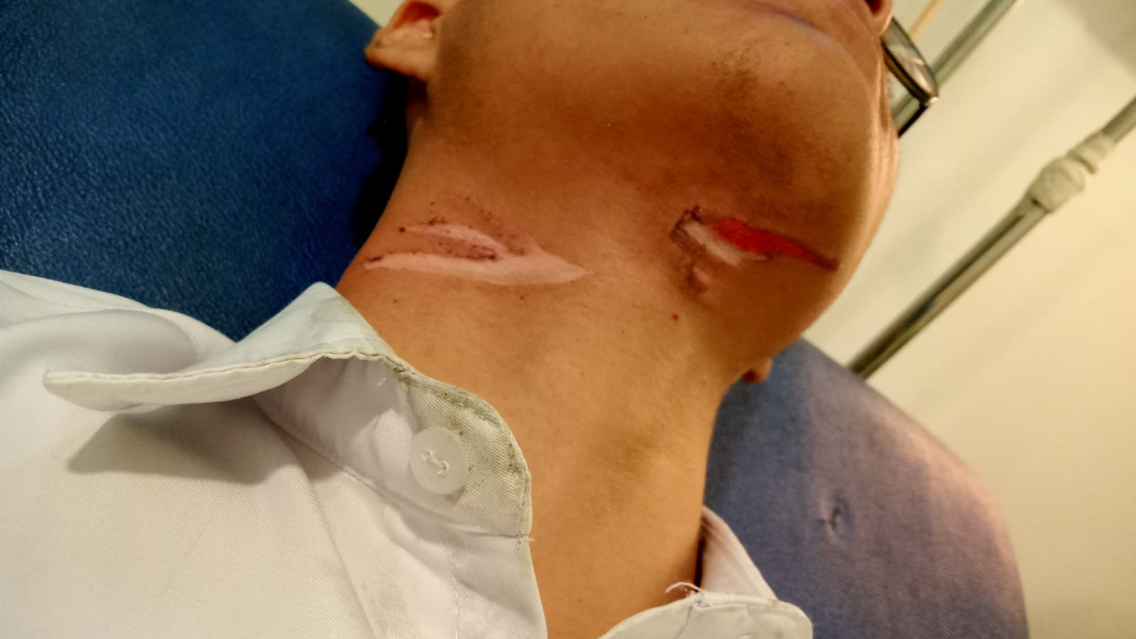 Dua Siswa Jatuh Terjerat Kabel Yang Melintang di Tengah Jalan SM Amin Pekanbaru