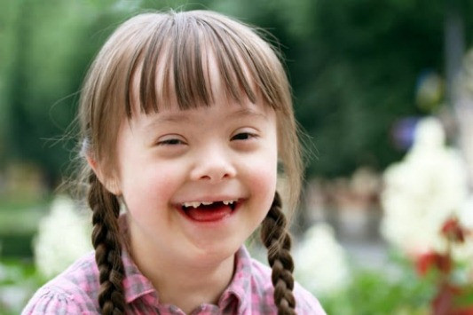 Fakta Unik pada Hari Down Syndrome Sedunia